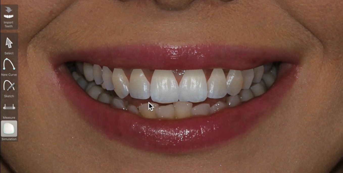 Dijital G&uuml;l&uuml;ş Tasarımı